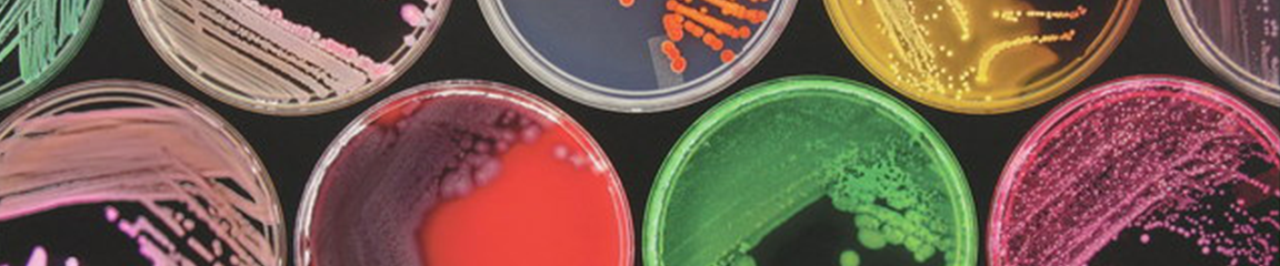 multi-colored petri dishes